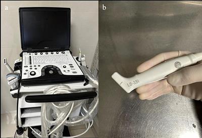 Application of intraoperative ultrasound in the resection of high-grade gliomas